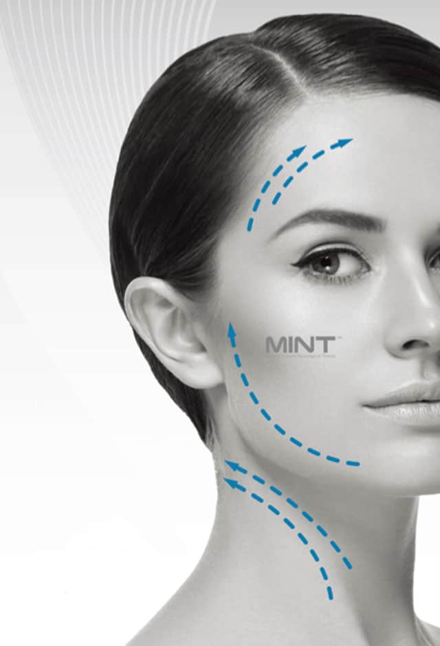 MINT. טכנולגיה קוראנית חוטים להרמת פנים ללא ניתוח. צילום״ יח״צ